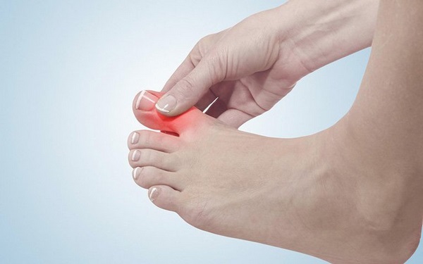 hỗ trợ điều trị bệnh gout